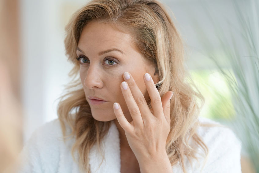 hormonal acne